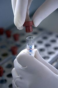 _images_lab-test-blood-3